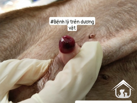 Phẫu thuật sỏi bàng quang 