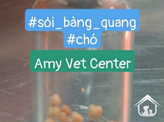 Phẫu thuật sỏi bàng quang 