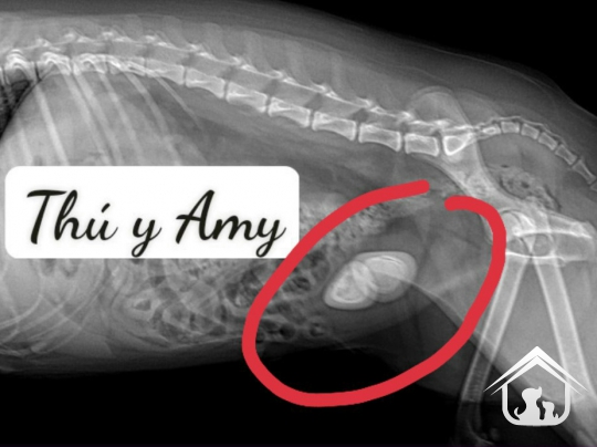 Phẫu thuật sỏi bàng quang 